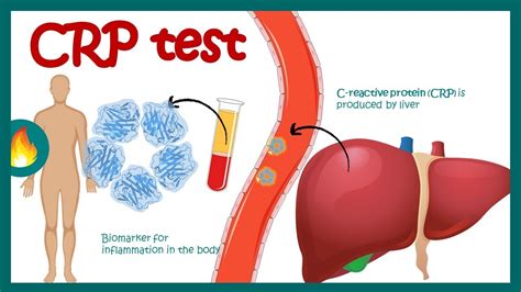 crp meaning in rpw|Exploring the Role of CRP in RPW: Unveiling Meanings and .